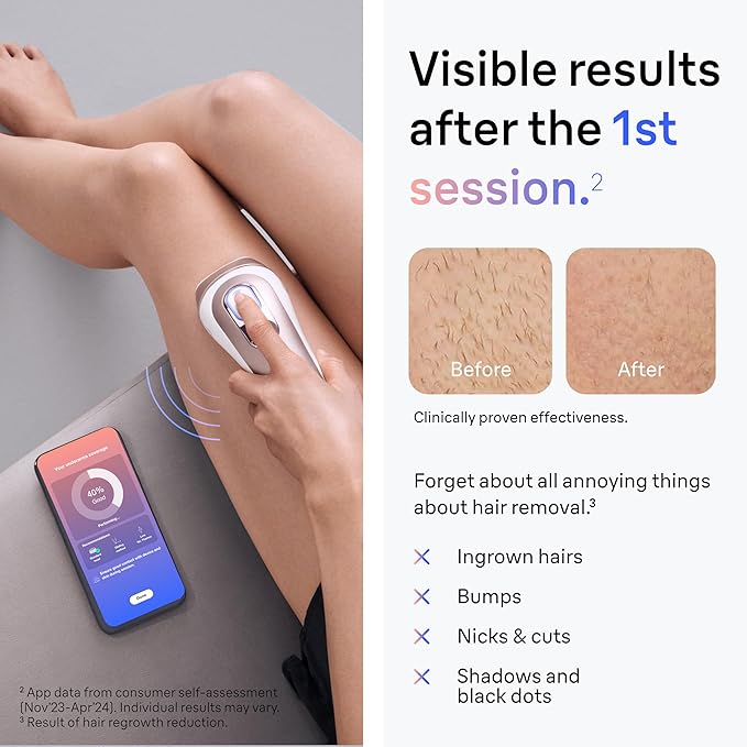 Braun IPL Skin i·Expert, at Home Laser Hair Removal, Permanent Visible Hair Reduction, with Free App, Smart IPL, Vanity Case, Venus Razor, 2 Smart Heads, Facial Trimmer, PL7219-Velvo Beauty
