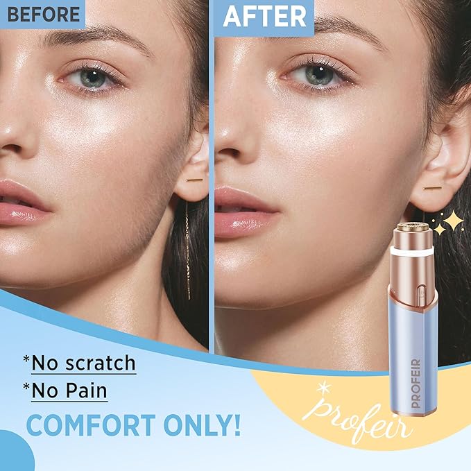 Facial Hair Removal for Women: Electric Hair Removal Device - Rechargeable Painless Face Razor for Chin Upper Lip Peach Fuzz with Light (Blue Gold)-Velvo Beauty
