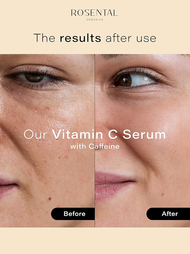 Organics Vitamin C Serum with Caffeine (30ml) – Hydrating Face Serum for Dark Spots, Acne Scars, Wrinkles – Brightening & Anti-Aging Facial Care – Natural Cosmetics – Made in Germany-Velvo Beauty