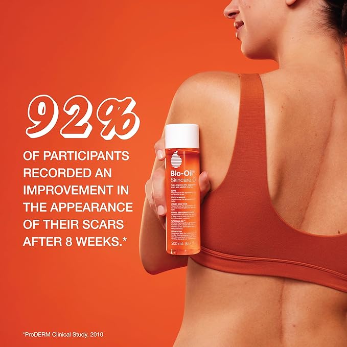 Bio-Oil Skincare Body Oil Serum for Scars and Stretch Marks, Face and Body Moisturizer with Vitamin E & A for Sensitive Dry Skin, Dermatologist Recommended, Non-Comedogenic, 4.2 Oz-Velvo Beauty