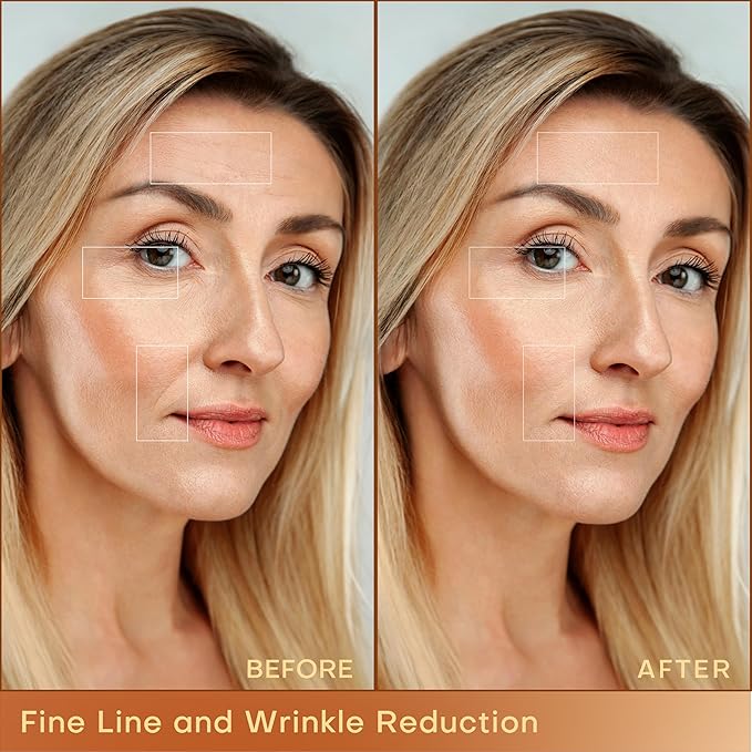 MLAY Professional RF Beauty Machine, Radio Frequency Face Machine with 2 Probes, at Home Radio Frequency Skin Tightening for Lifting, Wrinkle Reducing, Anti Aging - Salon Effects(Gel Included)-Velvo Beauty