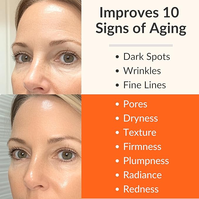 LeVaye Vitamin C Serum, Anti-Aging Face Serum – 15% Vitamin C, Ferulic Acid, Niacinamide, Hyaluronic Acid, Peptides, Ceramides – Targets Wrinkles, Fine Lines, Dark Spots, Enlarged Pores, Dry Skin-Velvo Beauty