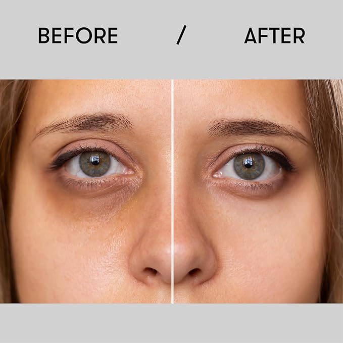 Sane Eye Cream for Dark Circles and Puffiness Treatment with Caffeine and Niacinamide - 0.34 fl oz, Hydrating Eye Cream for Dark Circles, Mornings without Puffiness-Velvo Beauty