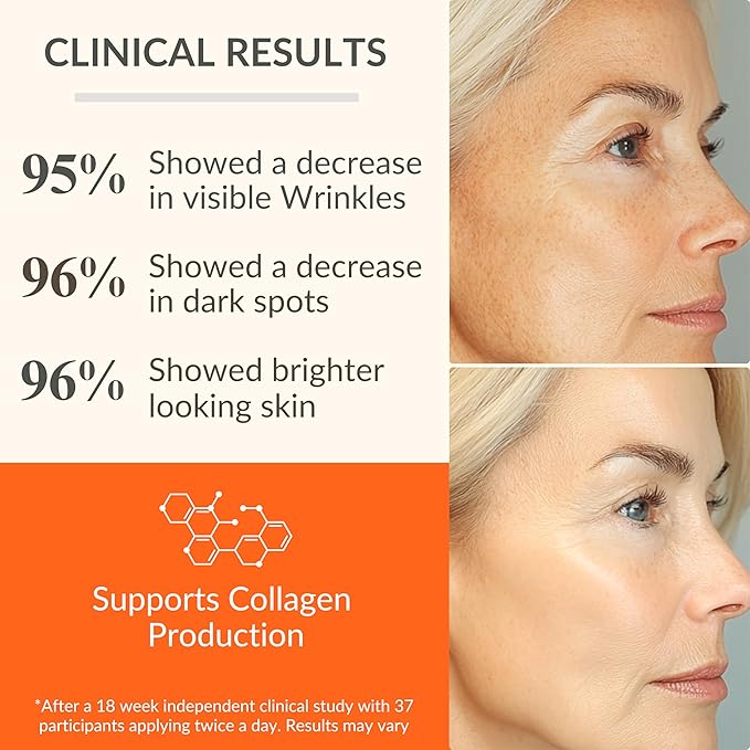 LeVaye Vitamin C Serum, Anti-Aging Face Serum – 15% Vitamin C, Ferulic Acid, Niacinamide, Hyaluronic Acid, Peptides, Ceramides – Targets Wrinkles, Fine Lines, Dark Spots, Enlarged Pores, Dry Skin-Velvo Beauty