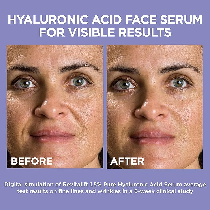 L'Oreal Paris Revitalift 1.5% Pure Hyaluronic Acid Face Serum 1.0 oz + True Match Lumi Glotion Natural Glow Enhancer Lotion, Medium 1.35 fl. oz, 1 kit-Velvo Beauty