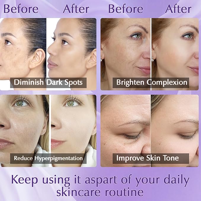Dark Spot Remover for Face Cream, Dark Spot Corrector, Rapid Tone Repair Retinol Serum for Sun Spots, Age Spots, Skin Brown, Melasma Skin Care with Upgraded Formula Vitamin C for Women 1.7 Fl OZ-Velvo Beauty