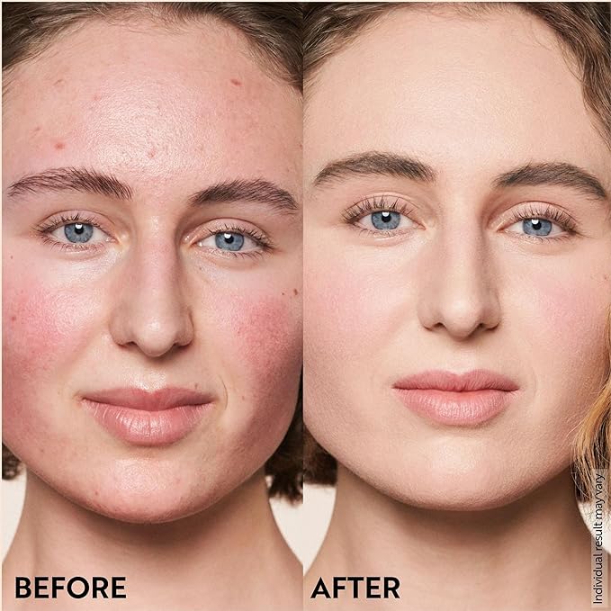 M. Asam Magic Finish Porcelain Teint Make-Up Mousse (1.01 Fl Oz) – 4in1 Primer, Foundation, Concealer & Powder With Buildable Coverage, Adapts To Fair Skin Tones, Leaves Skin Looking Flawless-Velvo Beauty