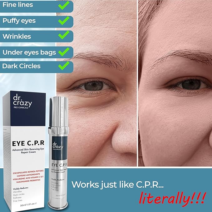 Eye C.P.R | Daily Caffeine & Retinol Under Eye Cream | All in One | Wrinkles & Fine Lines | Firming, Dark Circles, Puffiness | Complex Anti Aging Formula | 30ml-Velvo Beauty