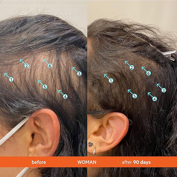 DS Labs Revita Shampoo and Conditioner – High-Performance Hair Density Shampoo & Conditioner, Volumizing & Thickening, Fuller, Healthier-Looking Hair, Sulfate & Silicone Free, For Men & Women, 205mL-Velvo Beauty