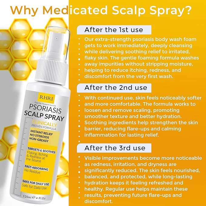 Psoriasis Scalp Spray | Psoriasis and Dandruff Treatment for Scalp Yeast Infections, Psoriasis Flare-Ups & Folliculitis | Antifungal Ringworm Itchy Scalp Spray for Psoriasis, Dryness-Velvo Beauty