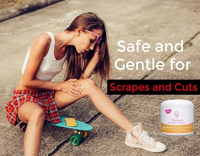 Best Stretch Marks Cream Prevent & Reduce Marks Reduce Pregnancy Stretch Marks Highly Concentrated Cream includes $29 Scar Reducing Guide-Velvo Beauty