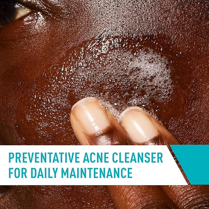 CeraVe Acne Control Cleanser, 2% Salicylic Acid Treatment Formulated With Niacinamide + Ceramides + Oil Absorbing Clay, Gentle Face Wash Helps Clear & Prevent Acne, Fragrance Free, 16 Ounce-Velvo Beauty