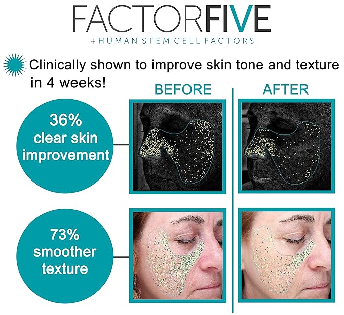Age Defying Cream with Stem Cell Growth Factors for Anti-Wrinkle, Collagen Boost, and Acne Scarring Repair, Large Size, 1fl oz/30ml-Velvo Beauty