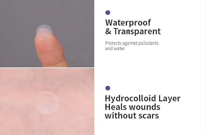 a.l.m. Magical Patch (2) Hydrocolloid pimple patches. These ultra thin & translucent hydrocolloid adhesive covers and absorb unwanted pimples. Parches Para Acne for skincare.-Velvo Beauty