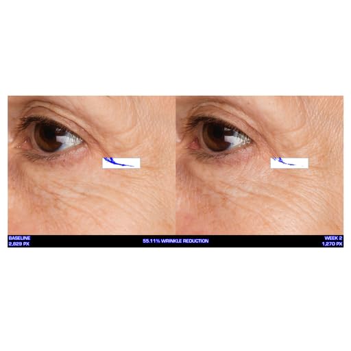 Serious Skincare Ultra-Mare Pure Marine Infusion Trio – Ultra-Mare Serum 1 oz, Ultra-Mare Facial Cream 2 oz. & Ultra-Mare Eye Cream .5 oz – Anti-Aging – Algae and Plankton extracts-Velvo Beauty