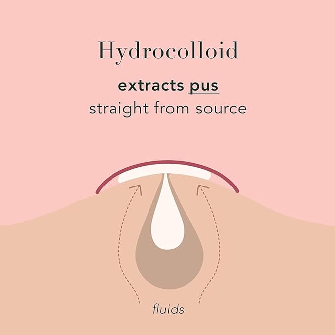 a.l.m. Magical Patch (2) Hydrocolloid pimple patches. These ultra thin & translucent hydrocolloid adhesive covers and absorb unwanted pimples. Parches Para Acne for skincare.-Velvo Beauty