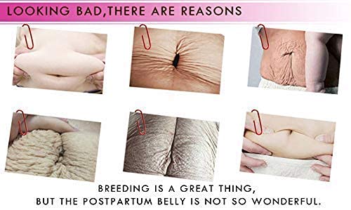 RtopR Mango Stretch Marks and Scar Cream -Stretch Marks and Scar Removal Cream for Pregnancy - Best Body Moisturizer-40g-Velvo Beauty