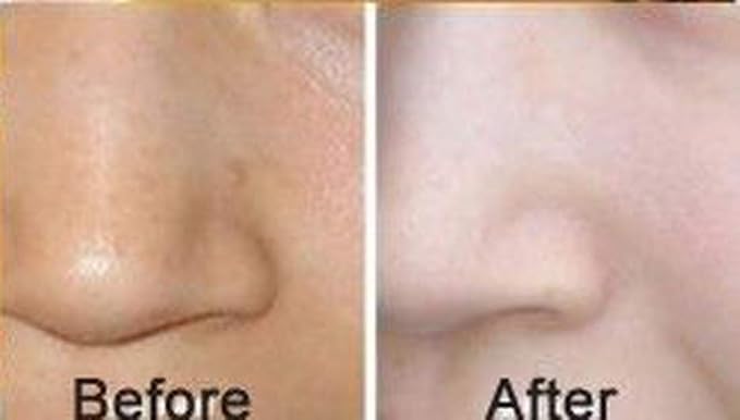 Luxurious 24k Gold Bio-collagen Facial Mask (5pcs)-Velvo Beauty