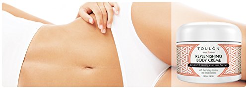 Bruise Cream with Arnica Montana, Shea Butter & Vitamin E: Repair Bruises, Stretch Marks Cream & Scars: 4 oz. For Women and Men-Velvo Beauty