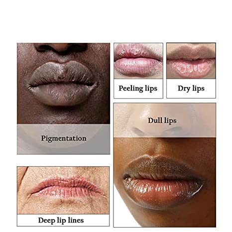2pcs Lip Lightening for Dark Lips Lip Brightener for Smokers Dark Lip Treatment Lightening Cream for Pink Lips Lip Lightener for Smoker Lips Lip Lightening balm for Men and Women (Red)-Velvo Beauty