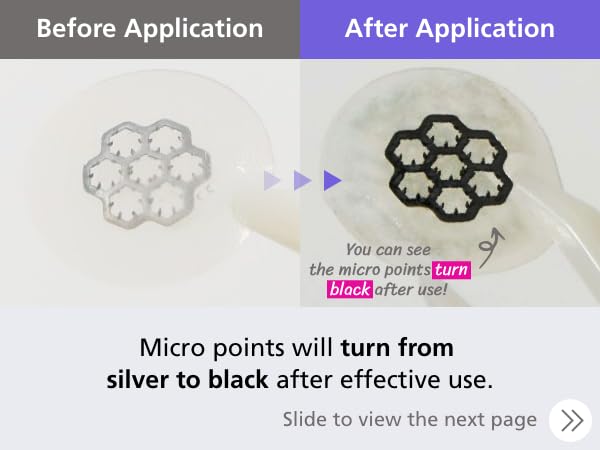 EasyDerm Magnesium Pimple Patches – Hydrocolloid Acne Spot Treatment with Ampoule & Tweezer, 10 Calming Zit Stickers by Daewoong, 이지덤, 대웅제약-Velvo Beauty