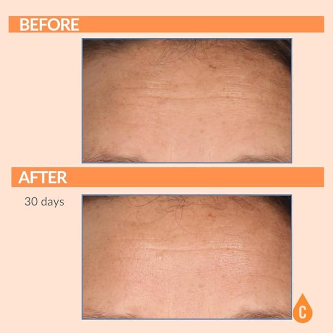 Serious Skincare Vitamin C Anti-Aging Facial Serum with Hydrolyzed Collagen - For Plump, Hydrated Skin - Brightening C3 Plasma Conditioner for Reducing Dark Spots, Fine Lines & Wrinkles 1 Fl Oz-Velvo Beauty