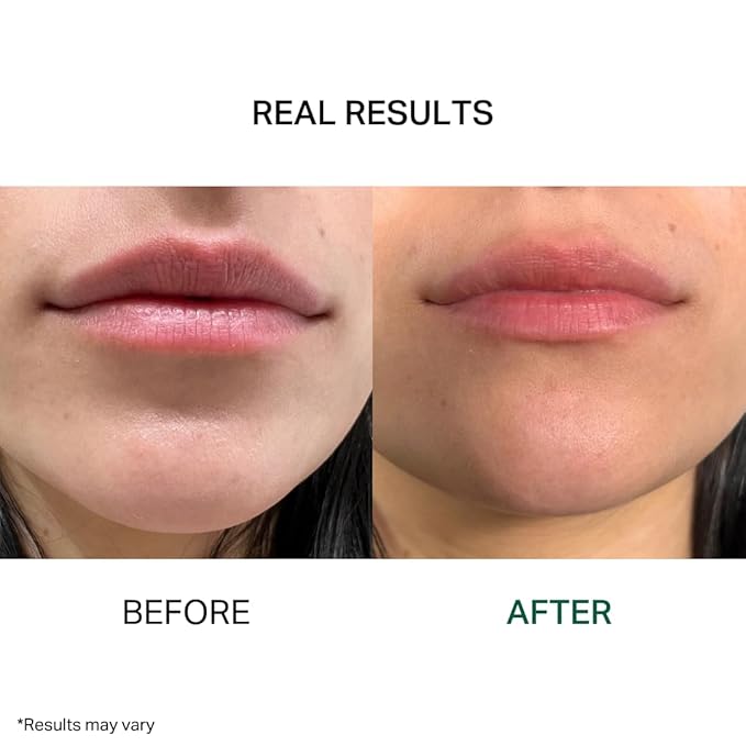 Y’OUR Intensive Lip Balm | Overnight Lip Mask: Lightweight & Comforting with Natural Shea Butter & Rosehip Oil; Extreme Moisturizer for Dry Lips. Paraben & Silicon-Free. Made in USA. 15ml (0.5 oz.)-Velvo Beauty