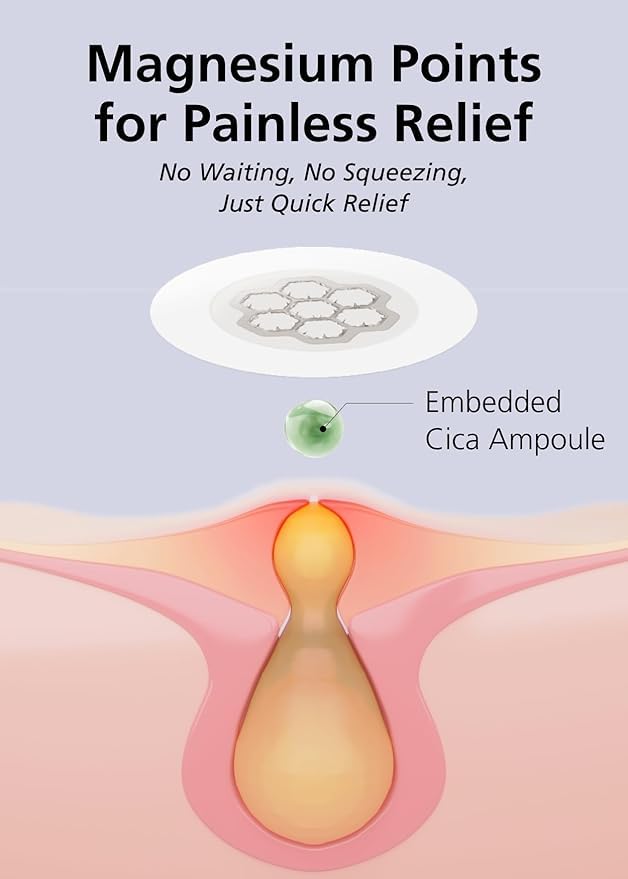 EasyDerm Quick Calming Magnesium Patches – 40 Patches (4 Pack), Hydrocolloid Acne Spot Treatment with Tea Tree & Cica, Bulk Value Pack for Acne-Prone Skin, Ideal for Home Skincare-Velvo Beauty