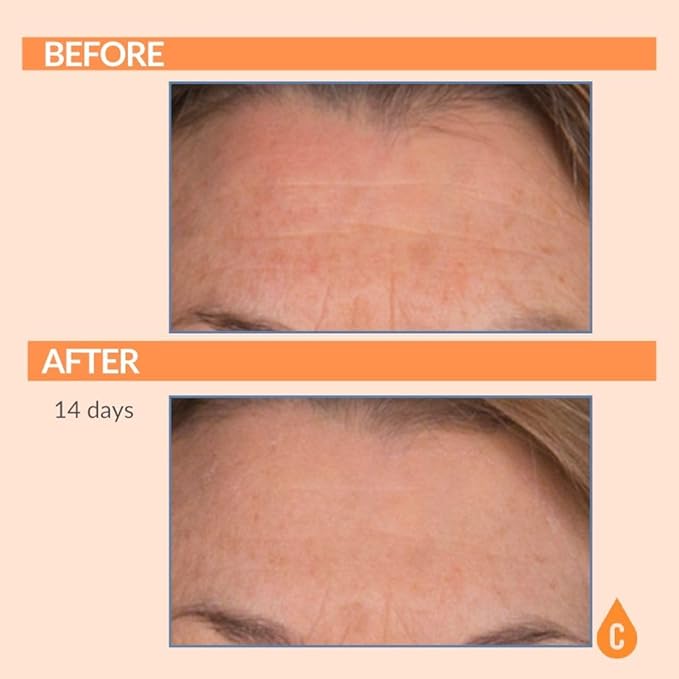 Serious Skincare Vitamin C Anti-Aging Facial Serum with Hydrolyzed Collagen - For Plump, Hydrated Skin - Brightening C3 Plasma Conditioner for Reducing Dark Spots, Fine Lines & Wrinkles 1 Fl Oz-Velvo Beauty