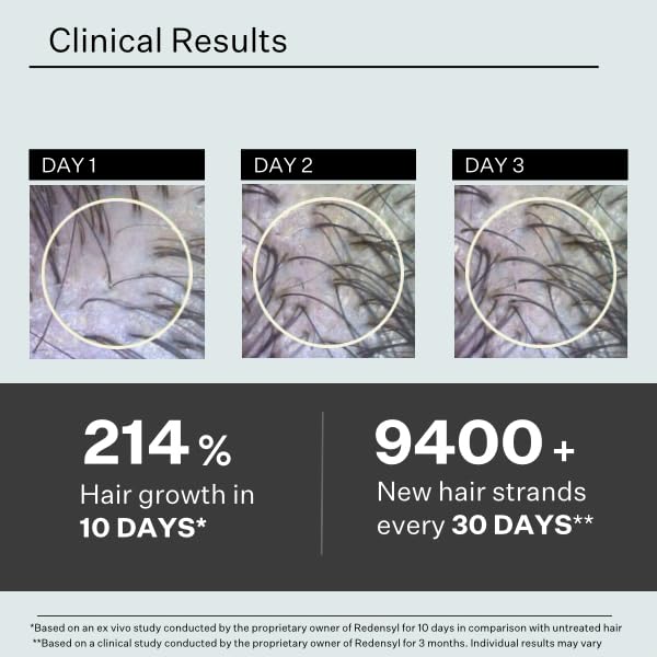 Stem Cell Serum for Men & Women - Helps Reduce Hair Loss - Strengthens & Thickens - Plant-Based - Combats Thinning Hair - Healthy Longer Hair - Root Nourishing Night (PM) - 28ml-Velvo Beauty