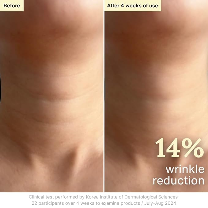 Rothea Resilience Cream, Anti-Aging with Bakuchiol 10,000ppm (Natural Retinol Alternative), Face Moisturizer, Neck Cream with Collagen, Ceramides, Peptides, Niacinamide, Korean Skin Care, 1.7 oz-Velvo Beauty