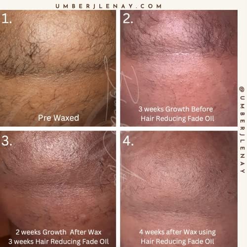 Hair Reducing Fade Oil - Sentive Strength (For sentive skin) Hair Growth Minimizer, Slow Down Facial Hair Growth for Women & Men, Hair Inhibitor Serum, Moisturizing & Soothing, 15ml-Velvo Beauty