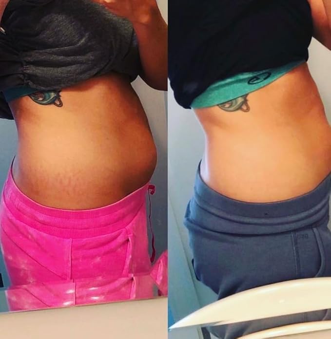 Promise Stretch Mark Prevention Kit, Scars and Dry Skin, Ultra-Hydrating Stretch Mark Cream and Stretch Mark Oil for Pregnant Women, Vegan, Non-Toxic, Set-Velvo Beauty