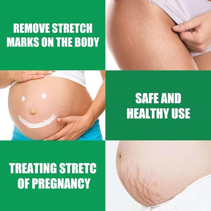 Wrinkle-Relaxing Firming Repair Essence Cream - Removes Maternity Stretch Marks, Prevents Wrinkles & Fine Lines, Nourishes & Rejuvenates Skin with Safe, Natural Formula-Velvo Beauty