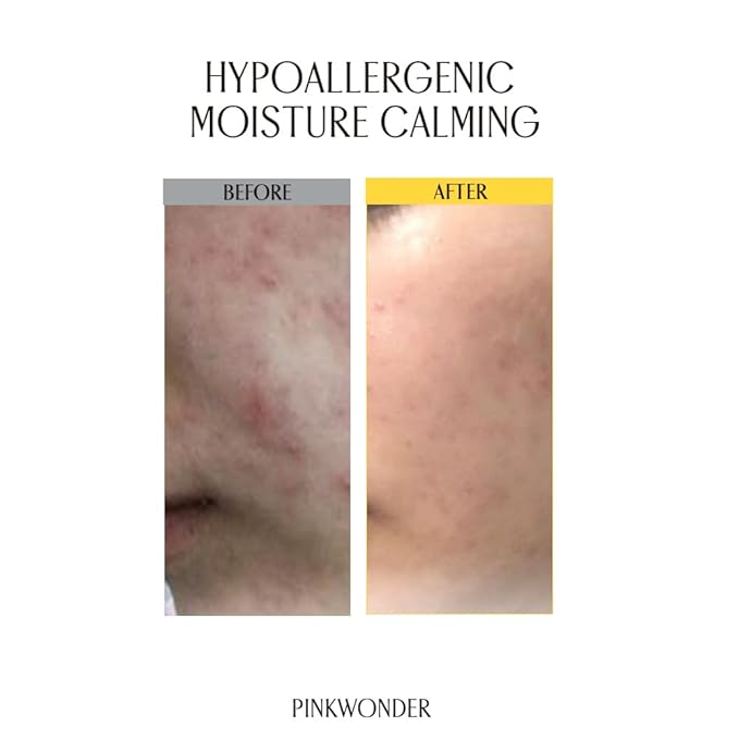 PINKWONDER Tamanu Hero Calming Gel 5.07oz (150ml) | Organic Tamanu Gel, Cooling, Soothing Instant Relief for Skin & Sunburn, Sunburn Relief, Alcohol Free, Gel cream, Korean Skincare-Velvo Beauty