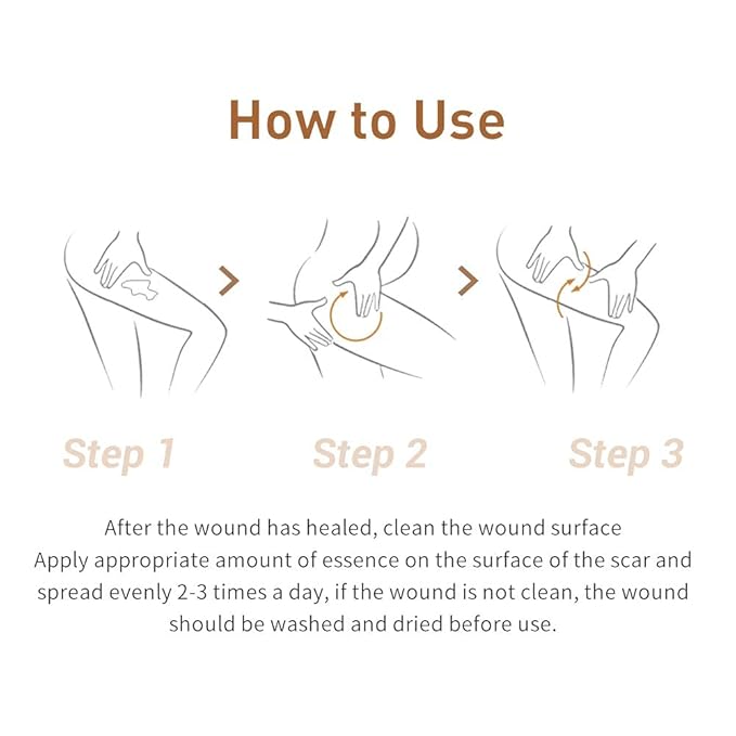 Acne Scar Removal Cream Stretch Marks Face Skin Cream Shrink Pores Gel-Fade Scar Marks Acne Skin Care (Packaging Upgrade) VeniCare-Velvo Beauty