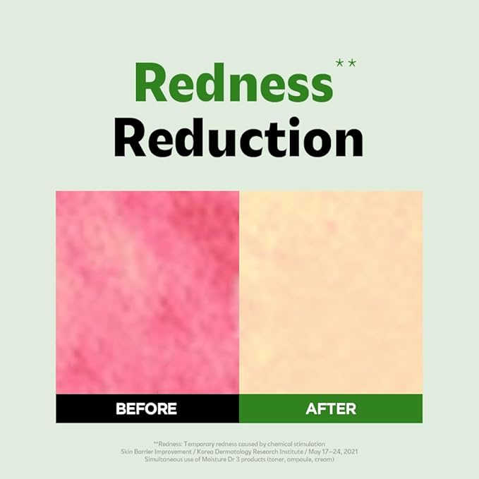 ISOI Moisture Dr. Soothing Cream, Deep Hydration & Barrier Support with Hyaluronic Acid, Lightweight Moisturizer for Sensitive Types, Korean Skin Care (2.37 fl.oz, 70ml)-Velvo Beauty