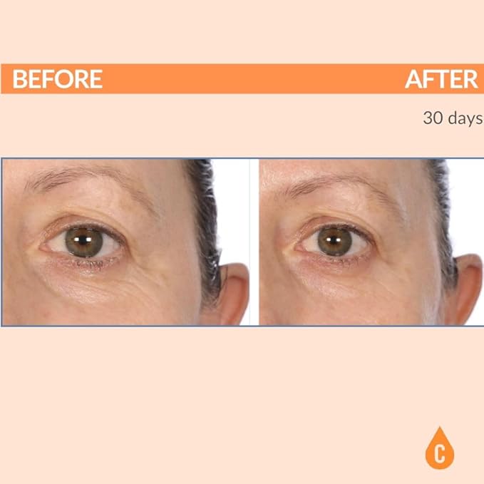 Serious Skincare - C3 Vitamin C Ester Eye Beauty Treatment with Hyaluronic Acid - For Dull & Dry Under Eyes - Soothing C3 Plasma Gel Formula for Fine Lines, Wrinkles, Discoloration - 0.5 oz.-Velvo Beauty