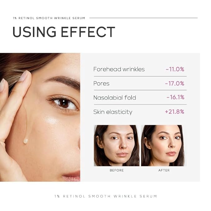 Anti Aging Skin Care Set, 1% Retinol Dark Spot Remover for Face with Face Serum & Moisturizer, Travel Size Skincare Set for Women, Reduce Wrinkles, Firm & Hydrate for All Skin Types-Velvo Beauty