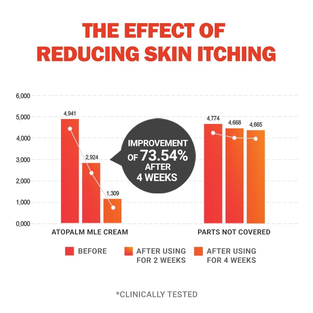 ATOPALM | MLE Eczema Cream | Premium Baby Lotion Newborn | Baby Face and Body Moisturizer for Skin Barrier | Moisturizing Facial Cream for Itchiness & Redness | Korean Skincare | 2.2 fl oz (65ml)-Velvo Beauty