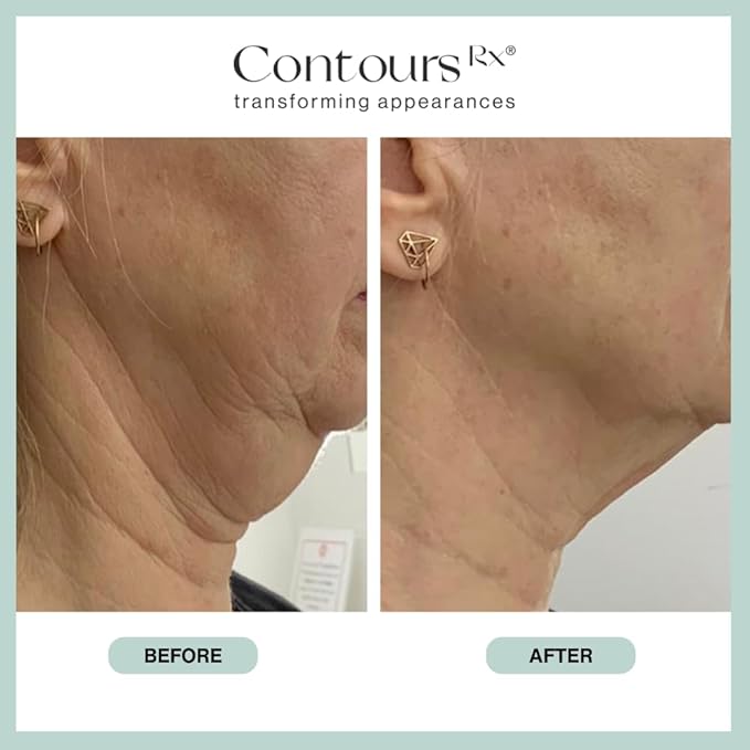 Neck Rescue Instant Correcting Strips – Invisible Lift Tape for Turkey Neck, Sagging Skin, and Wrinkles | Face & NeckTape Lifting for a Smooth, Tight Neckline – Long-Lasting Hold, 30 Count-Velvo Beauty