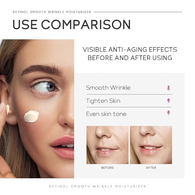 Anti Aging Skin Care Set, 1% Retinol Dark Spot Remover for Face with Face Serum & Moisturizer, Travel Size Skincare Set for Women, Reduce Wrinkles, Firm & Hydrate for All Skin Types-Velvo Beauty