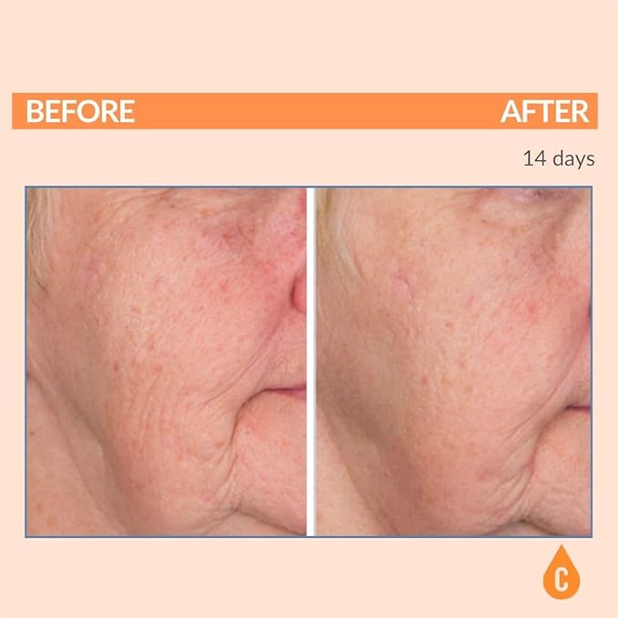 Serious Skincare Vitamin C Anti-Aging Facial Serum with Hydrolyzed Collagen - For Plump, Hydrated Skin - Brightening C3 Plasma Conditioner for Reducing Dark Spots, Fine Lines & Wrinkles 1 Fl Oz-Velvo Beauty