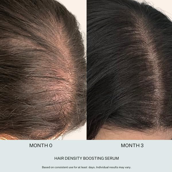 Stem Cell Serum for Men & Women - Helps Reduce Hair Loss - Strengthens & Thickens - Plant-Based - Combats Thinning Hair - Healthy Longer Hair - Root Nourishing Night (PM) - 28ml-Velvo Beauty