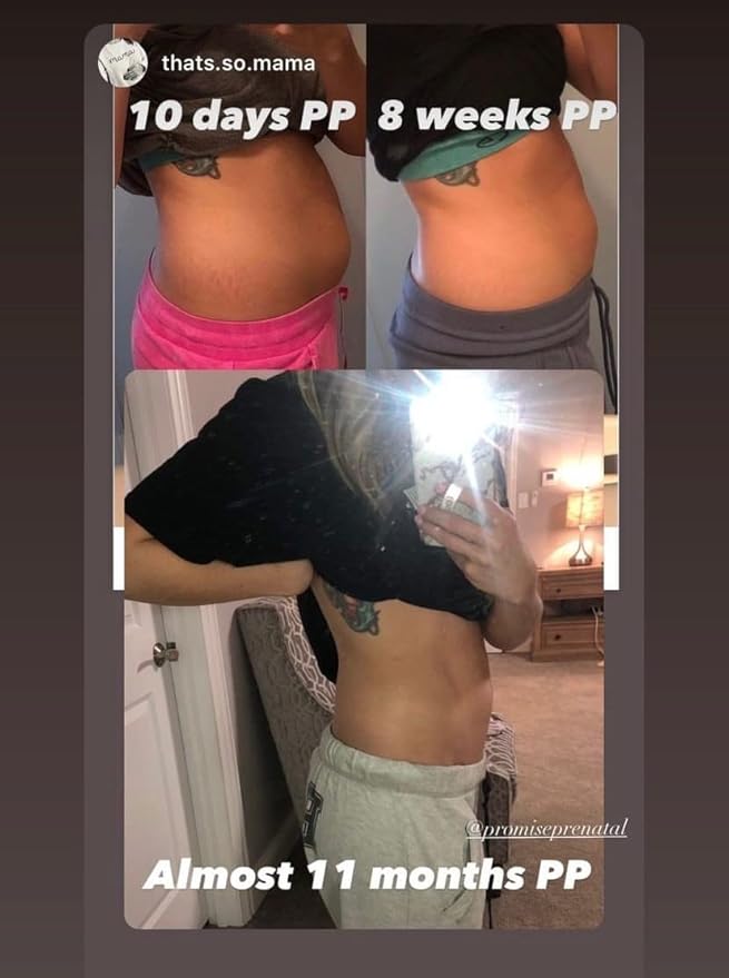 Promise Stretch Mark Prevention Bump Oil, Defense + Repair, Clean Pregnancy Skincare, Non-Toxic, Pregnancy Belly Oil, Vegan, Fast Drying-Velvo Beauty