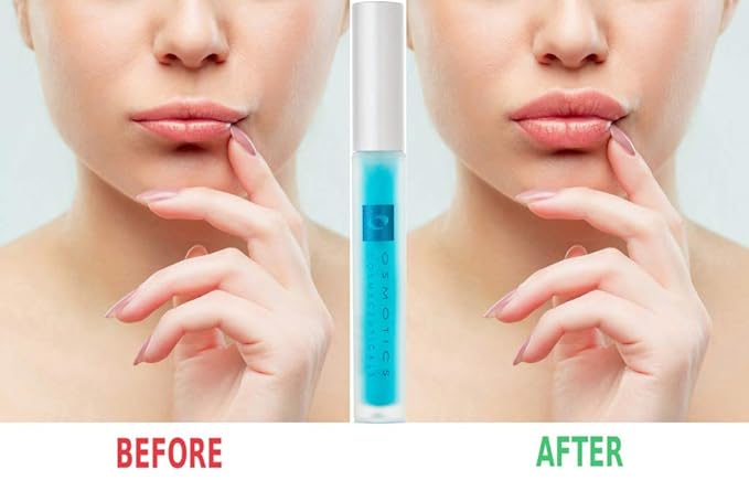 Osmotics Lip Plumper, Best Natural Lip Enhancer, Lip Gloss With Hyaluronic Acid, Hydrating, High Shine, Increase Lip Elasticity, Get Fuller & Hydrated Youthful Sexy Looking Lips-Velvo Beauty