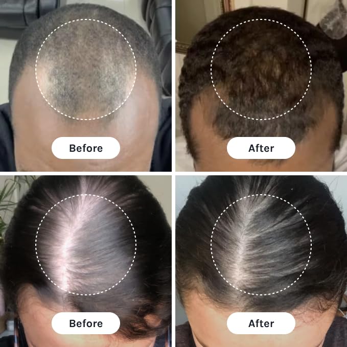 InfiniWell PTD-DBM Peptide Hair Serum for Fuller-Looking Hair - Scalp Treatment for Visible Growth & Follicle Renewal - Reinforce Restoration, Strand Integrity & Optimal Density (25 ml)-Velvo Beauty