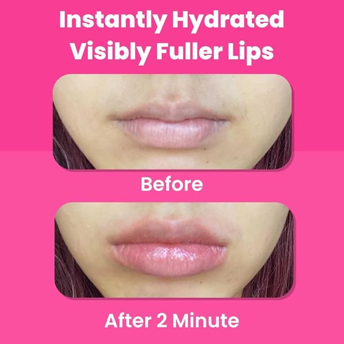 One Minute Lip Plumper Patch - Instant Lip Hydration Patch with Hyaluronic Acid & Collagen Microvector from Tarel Laboratory-Velvo Beauty