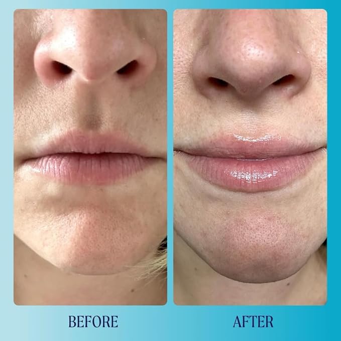 Kinship Supermelt Lip Plumping Jelly Mask - Moisturizing Daily Lip Treatment + Hyaluronic Acid - Hydrating + Exfoliating Lip Gloss - Soft, Smooth, Plump - Quick Melting Balm - Soothe Dry Lips (.3 oz)-Velvo Beauty