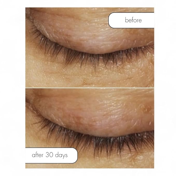 Serious Skincare Lash Bath & Conditioner - Double Action Eye Makeup Remover - Oil Free - Enhancing Peptides Promotes Eyelash Growth - Clover Flower - Effortlessly Removes Waterproof Mascara - 4 oz.-Velvo Beauty